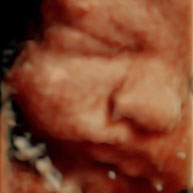 baby2